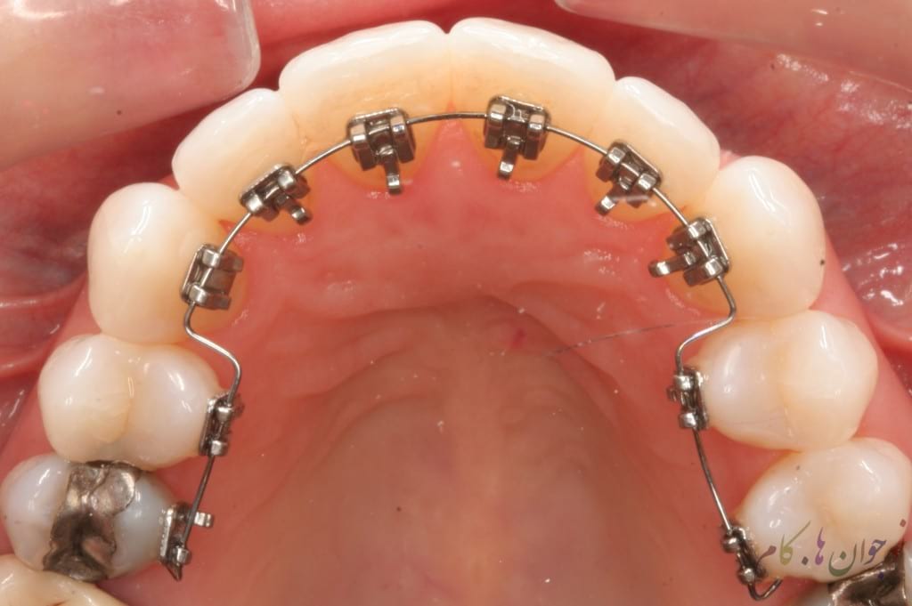 Orthodontics.nojavanha (4)