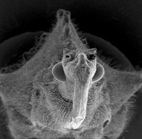 تصویری از میکروب های زیر ناخن